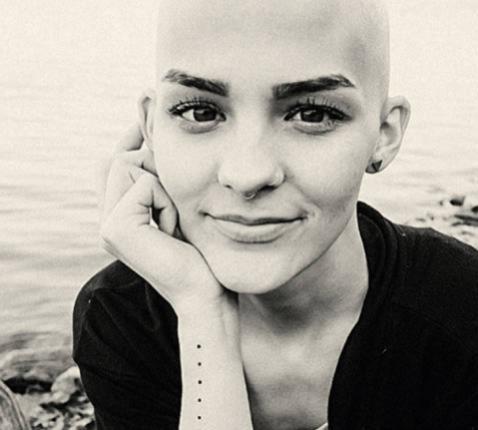 Het kale meisje in het donker 