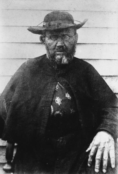 Pater Damiaan, ondertussen zelf besmet met lepra, 1889 © William Brigham