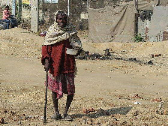 Een leprapatiënt in India © Vatican Media